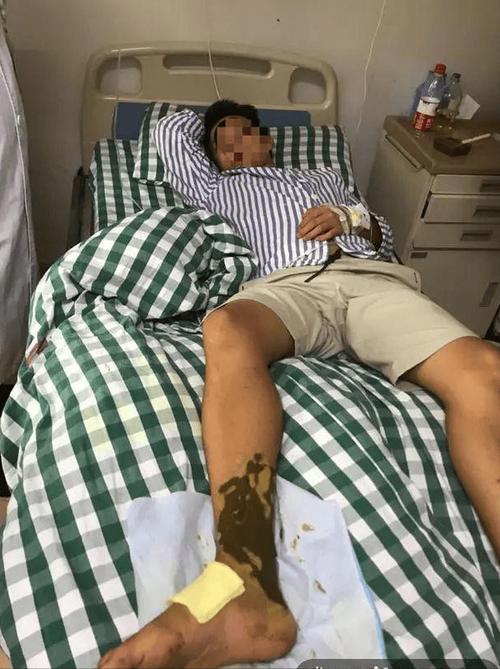新奥2025今晚开奖资料和被蛇咬反抓蛇再遭咬与被蛇咬反抓蛇再遭咬伤